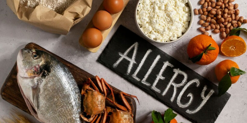 Photo of multiple types of food with the word allergy written on a chalk board in the middle